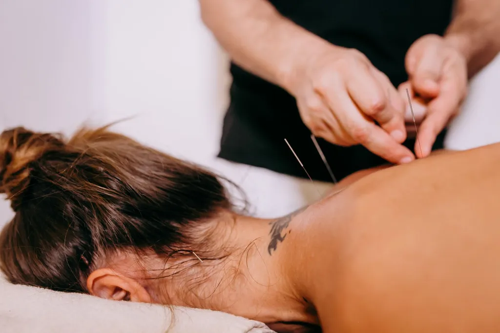 Acupuncture needles placed along a patient’s back during a calm clinic session